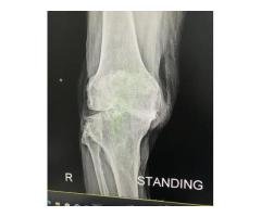 Male Nurse Available for Night Shift